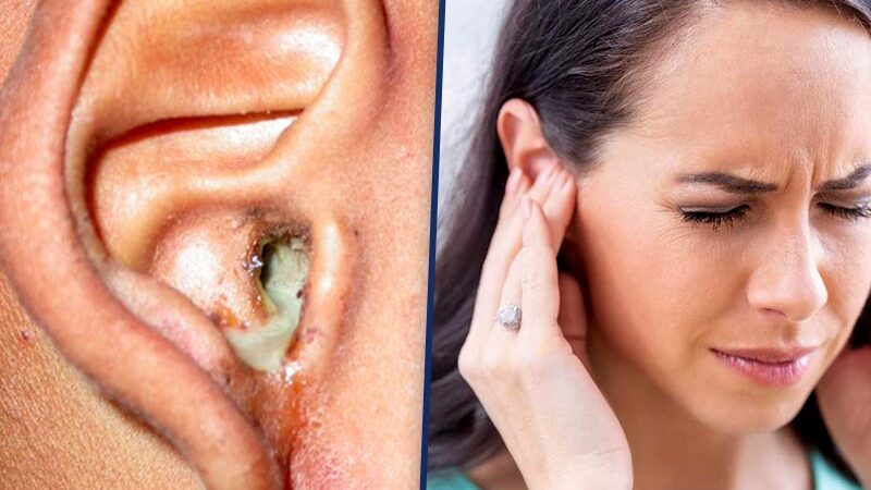 कान की समस्या का मतलब होता है "Ear Problem" या "Problem Related To The Ear"यह कई प्रकार की हो सकती है, जैसे