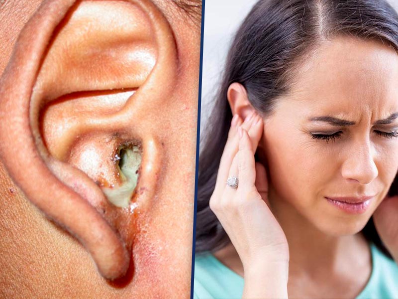 कान की समस्या का मतलब होता है “Ear Problem” या “Problem Related To The Ear”यह कई प्रकार की हो सकती है, जैसे