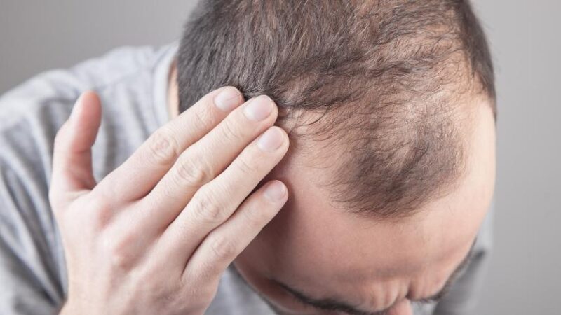बाल गिरने का कारण और उपाय (Hair Fall Causes and Remedies in Hindi)